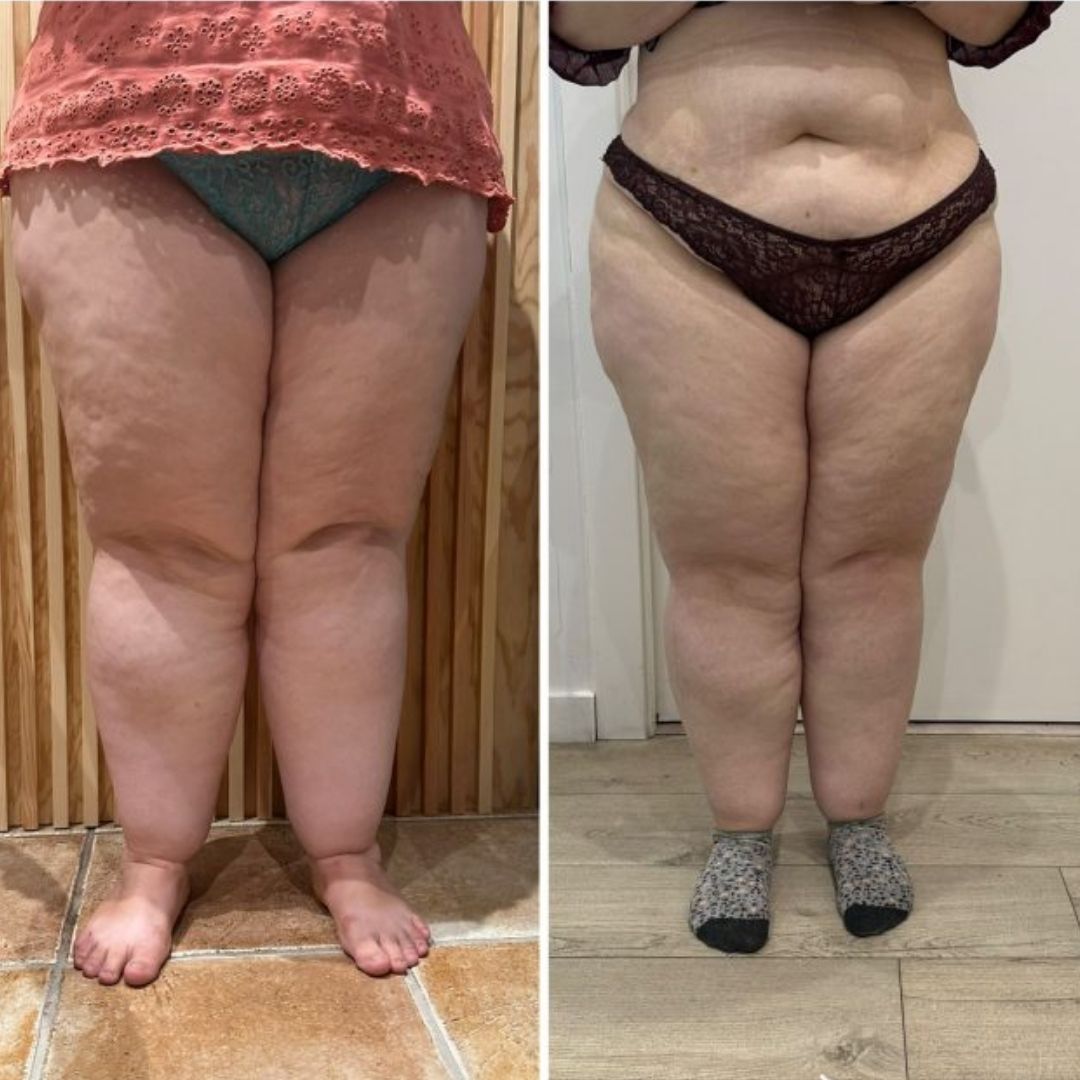 Transformación de Andrea